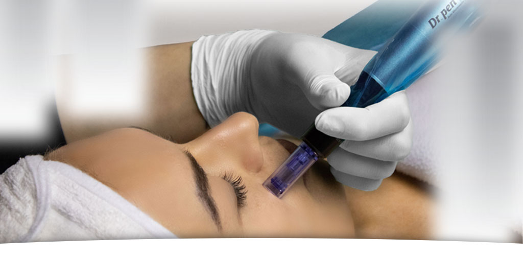 Microneedling mesotherapy