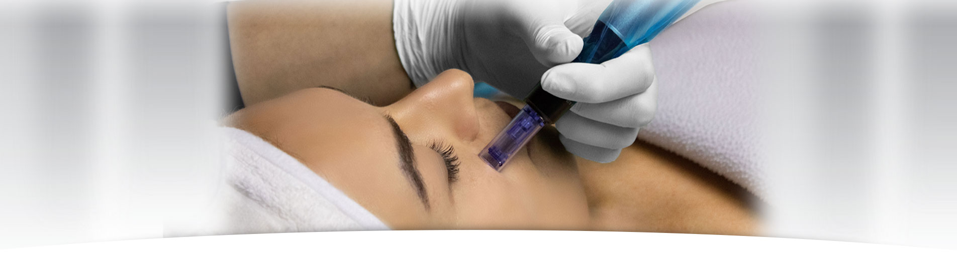 Mésothérapie par microneedling