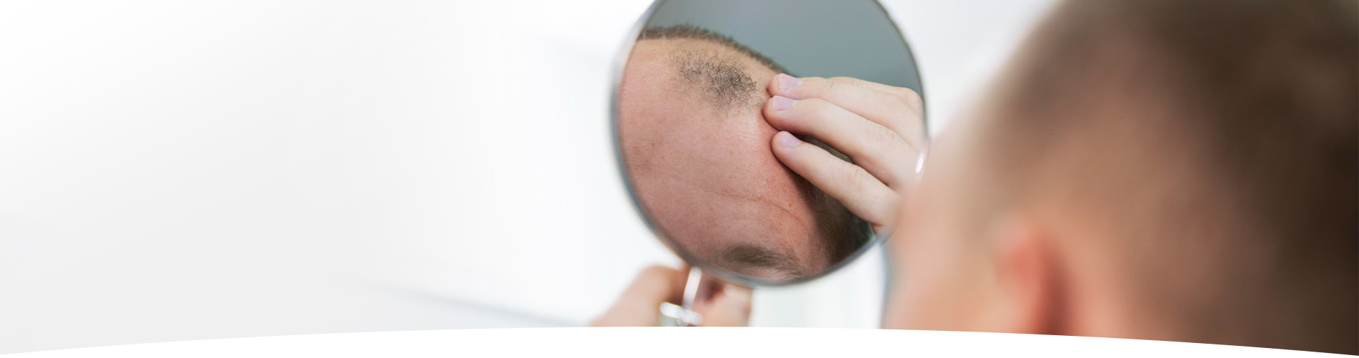 Perte de cheveux