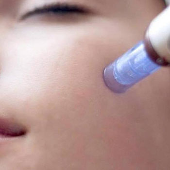 Microneedling