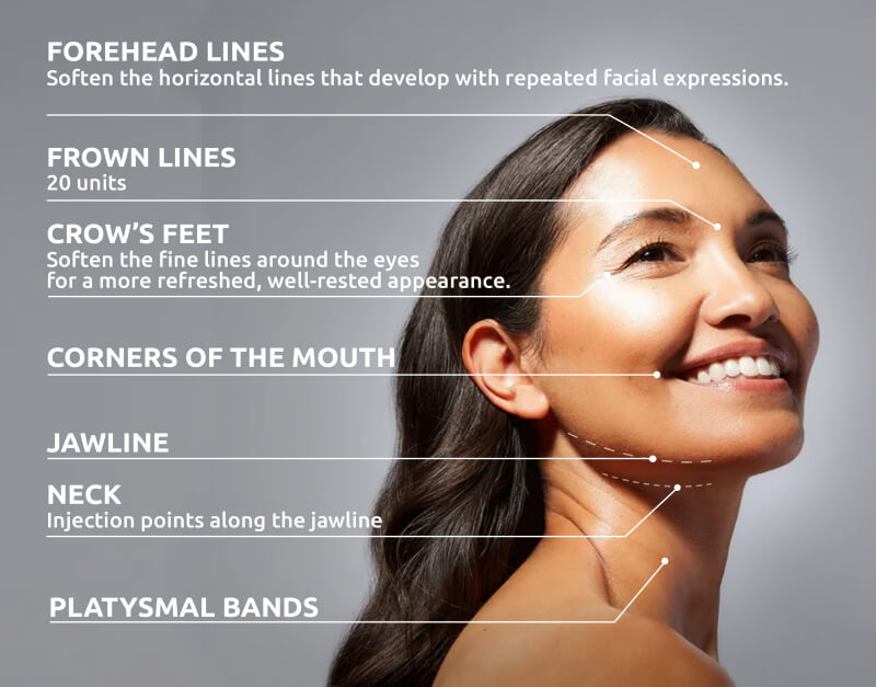Zones Injections botox