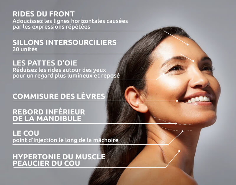 Zones Injections botox